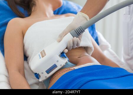 coolsculpting tucscon