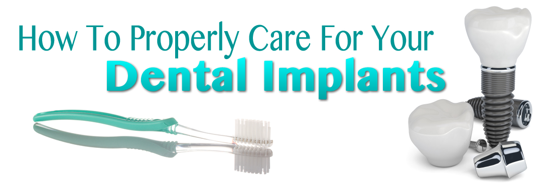 Dental Implants